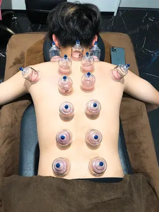 美容鍼灸整体サロンBeauJu所属・小顔矯/美容鍼/鍼灸 BeauJuのその他イメージ