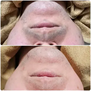 メンズ Iryアイリー所属・Iry アイリーのエステ・リラクイメージ