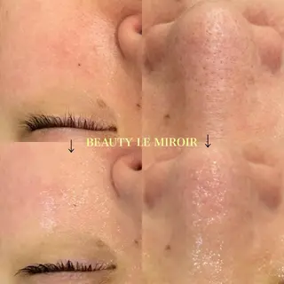 ビューティー ミロワールのエステ・リラクイメージ