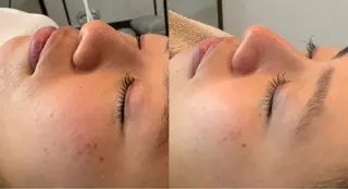 最速小顔・肌質管理 espoirマキのエステ・リラクイメージ