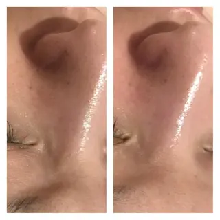 ネイル フェアリーローズ所属・fairyrose organicエステのエステ・リラクイメージ