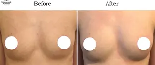 光フォト美容 エイジング、敏感肌のエステ・リラクイメージ