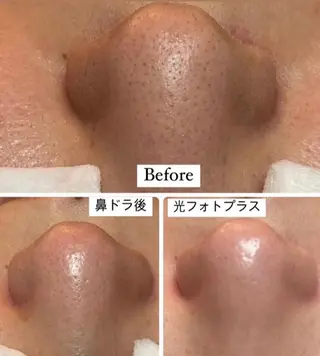 美顔秘密基地新宮所属・美顔秘密基地 新宮のその他イメージ