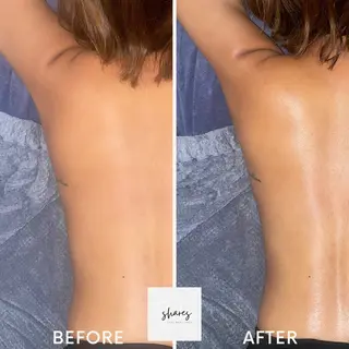 SHARES MADOKAのエステ・リラクイメージ