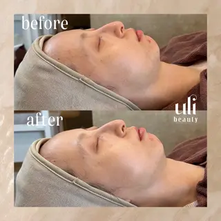 uli beauty所属・韓国肌管理サロン ulibeautyのエステ・リラクイメージ