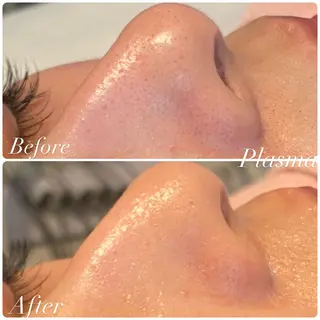 綺麗のひみつ グランプリ受賞店のエステ・リラクイメージ