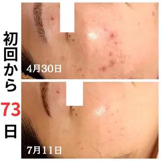 フェイシャル専門サロ ン ERINのエステ・リラクイメージ