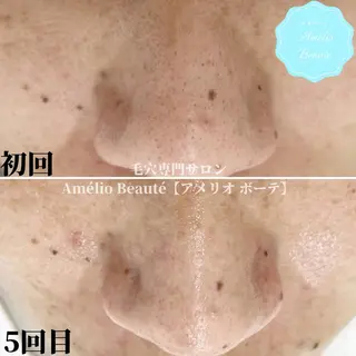 メンズ 毛穴ケア専門サロン Amélio Beauté所属・毛穴ケア専門サロン アメリオボーテのその他イメージ