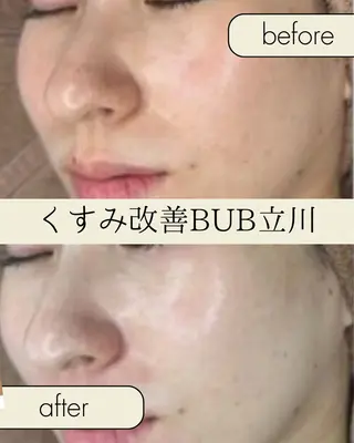 【BUB立川】 ゆかのエステ・リラクイメージ