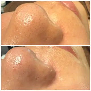 Relaxationsalon Prima所属・リンパ/足もみ/美肌 【Prima】井川のエステ・リラクイメージ