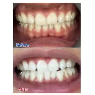 M渋谷店所属・M渋谷 ホワイトニングのエステ・リラクイメージ