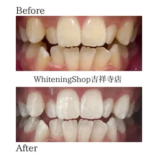 ホワイトニング ショップ吉祥寺店のエステ・リラクイメージ