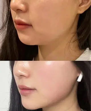 ショート 愛維美水光美肌専門店所属・愛維美水光美肌専門店 メンズレディースokのエステ・リラクイメージ