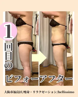 bellissimo 【ベリッシモ】所属・ちひろ　痩身/ハーブ bellissimoのエステ・リラクイメージ