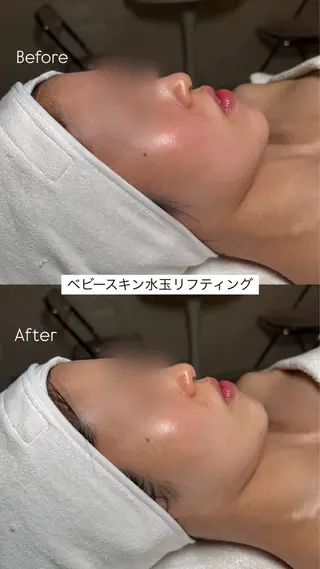 韓国肌管理🫧LDM 🫧Junnaのエステ・リラクイメージ