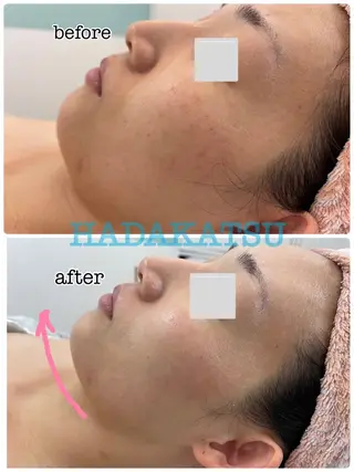 総合エステサロン 肌活のエステ・リラクイメージ