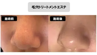 ヴィーナス ビューティーのエステ・リラクイメージ