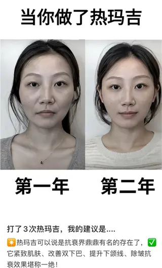 マツエク・マツパ aliaハイフ&水光ジェットサロン所属・aliaハーブ水光店 エステティシャン募集のエステ・リラクイメージ