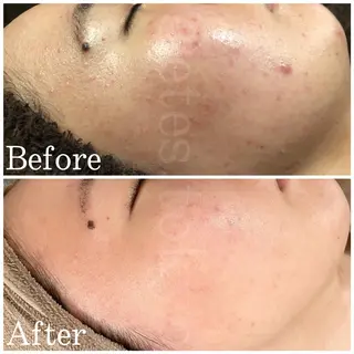 etes （エトエス）所属・etes.tokyo 中目黒のエステ・リラクイメージ