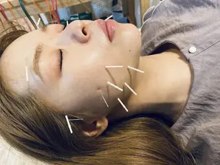 むくみたるみ専門☆ 美容鍼・小顔矯正のエステ・リラクイメージ