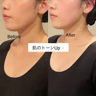 小顔•美容矯正Bholic所属・小顔・骨格矯正 Bholic 日本橋のエステ・リラクイメージ