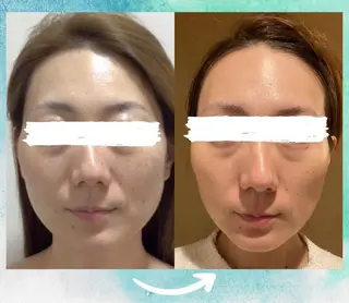 エステ♡Eden Asamiのエステ・リラクイメージ