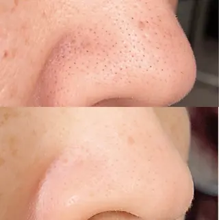 Nicore所属・肌質改善🌿まつ毛 chapiのその他イメージ