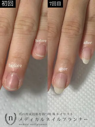 ネイル Lofinails ちひろのネイルデザイン