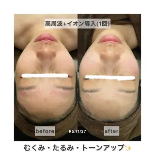 【Folche 春日店】馬場・大内田のエステ・リラクイメージ