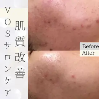 Purua beuty所属・月1肌管理 RINAのエステ・リラクイメージ