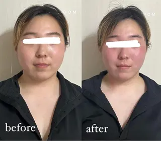 結果重視の温活美容 CARNAのエステ・リラクイメージ