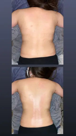 SHARES MADOKAのエステ・リラクイメージ