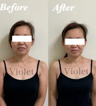 耳つぼサロン バイオレット　りののその他イメージ