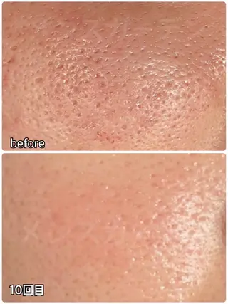 メンズ メンズガーデン今池店所属・メンズガーデン 今池の眉毛・アイブロウイメージ