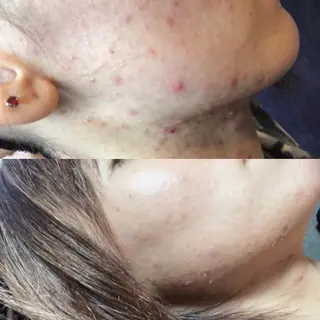 小顔×痩身専門サロンCLORE浦和店所属・石川 彩花のエステ・リラクイメージ