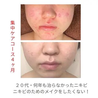 ベラージュ【美背中・ 美尻・フェイシャル】のエステ・リラクイメージ