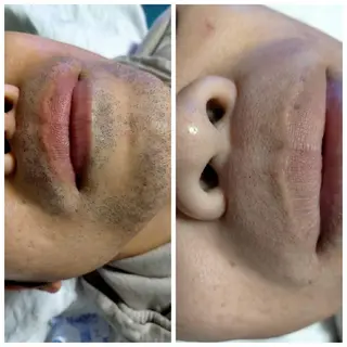 メンズ muscle＆esthe jonny's beauty所属・jonny's beautyのエステ・リラクイメージ