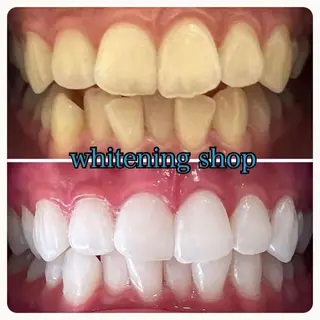 ホワイトニング ショップ吉祥寺店のエステ・リラクイメージ