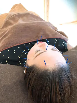 HARIKA鍼灸所属・HARIKA 鍼灸のその他イメージ