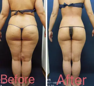 BELINDA銀座店 ✨痩身エステサロン✨のエステ・リラクイメージ