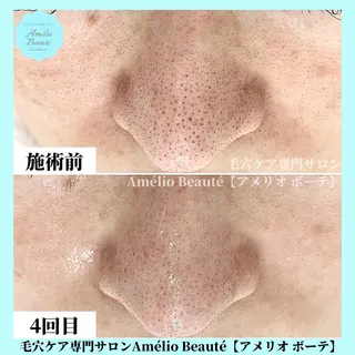 毛穴ケア専門サロン Amélio Beauté所属・毛穴ケア専門サロン アメリオボーテのその他イメージ