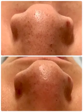 メンズ ビューティーサロン ソナタのエステ・リラクイメージ