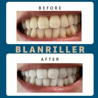 BLANRILLER所属・ホワイトニングサロン ブランリエ阿倍野店のその他イメージ