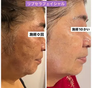 Private Salon Prunelle所属・プライベートサロン プリュネルのエステ・リラクイメージ