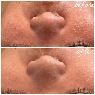 メンズ メナード岐阜市茜部 杉浦のエステ・リラクイメージ