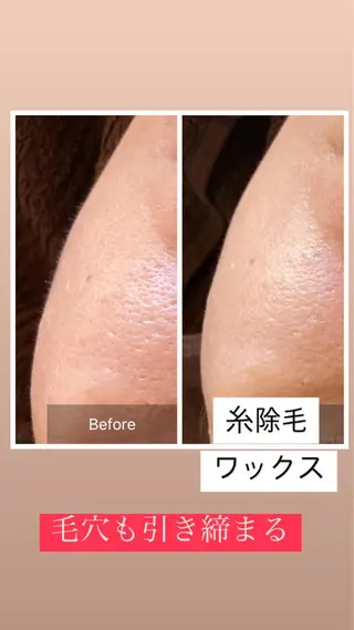 産毛専門店 Bittoのエステ・リラクイメージ