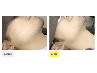 メンズ 都度払い脱毛⭐️ 脱毛サロンMIRACのエステ・リラクイメージ