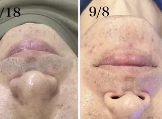 メンズ まつげパーマ×眉毛×脱毛　Cerise Lala所属・CeriesLaLa 大船店のマツエク・マツパデザイン