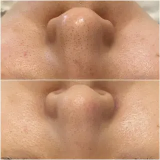 ララ/ハーブ メゾンリュバンのエステ・リラクイメージ