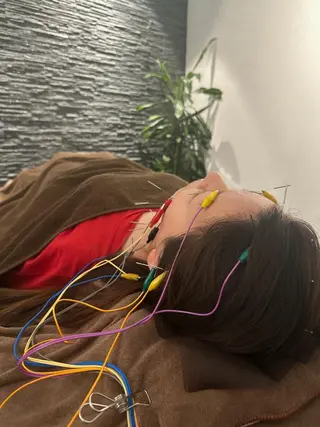 美容鍼灸整体サロンBeauJu所属・小顔矯/美容鍼/鍼灸 BeauJuのその他イメージ